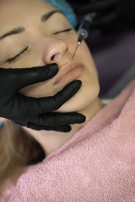 Physician in black gloves injecting botulinum toxin with a fine needle into the face of a patient lying back