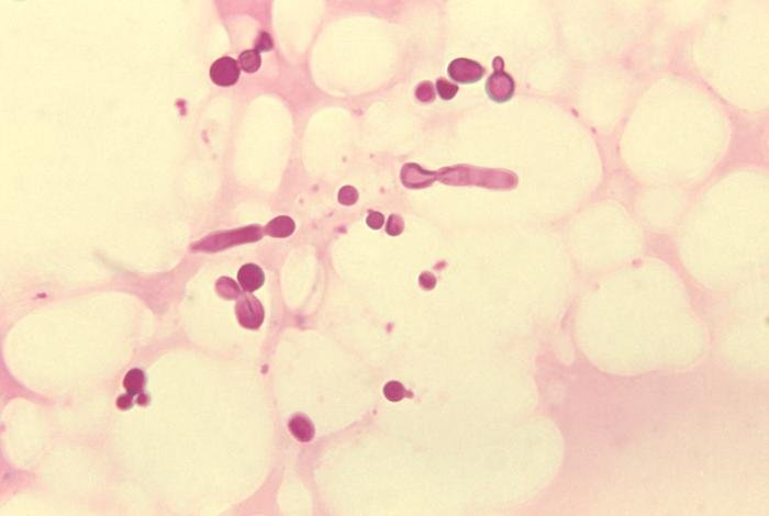 Malassezia furfur in skin scale from a patient with tinea versicolor PHIL 3938 lores · ¿Cuáles son las causas de la dermatitis seborreica?