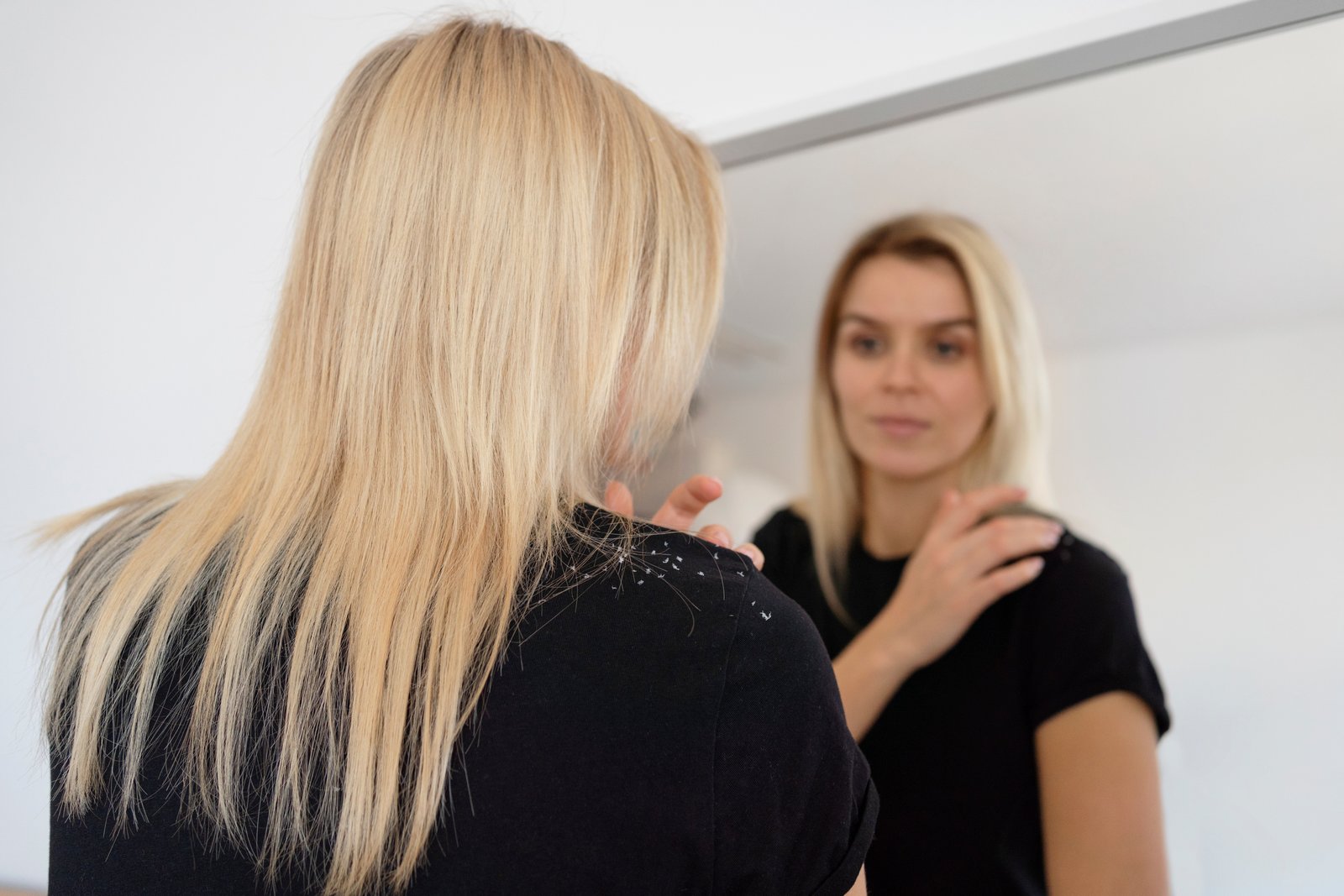 Medium shot woman with dandruff looking mirror · ¿Cuáles son las causas de la dermatitis seborreica?