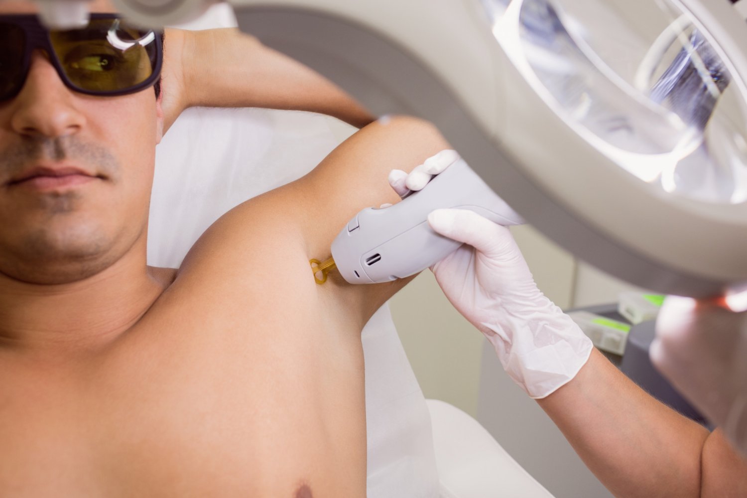 Underarm laser hair removal, another aesthetic treatment for men