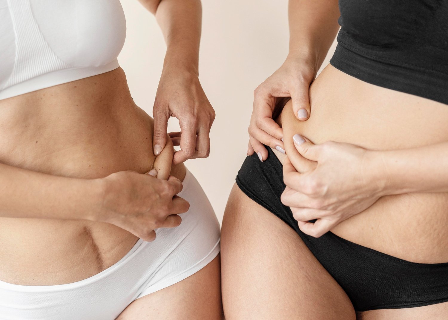 Dos mujeres en ropa interior se pellizcan la piel del abdomen y la cadera, donde se aprecia textura de piel de naranja