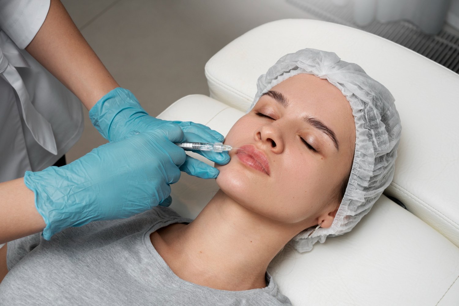 Gloved physician injecting hyaluronic acid into the lip of a patient lying on a treatment bed during a lip filler procedure