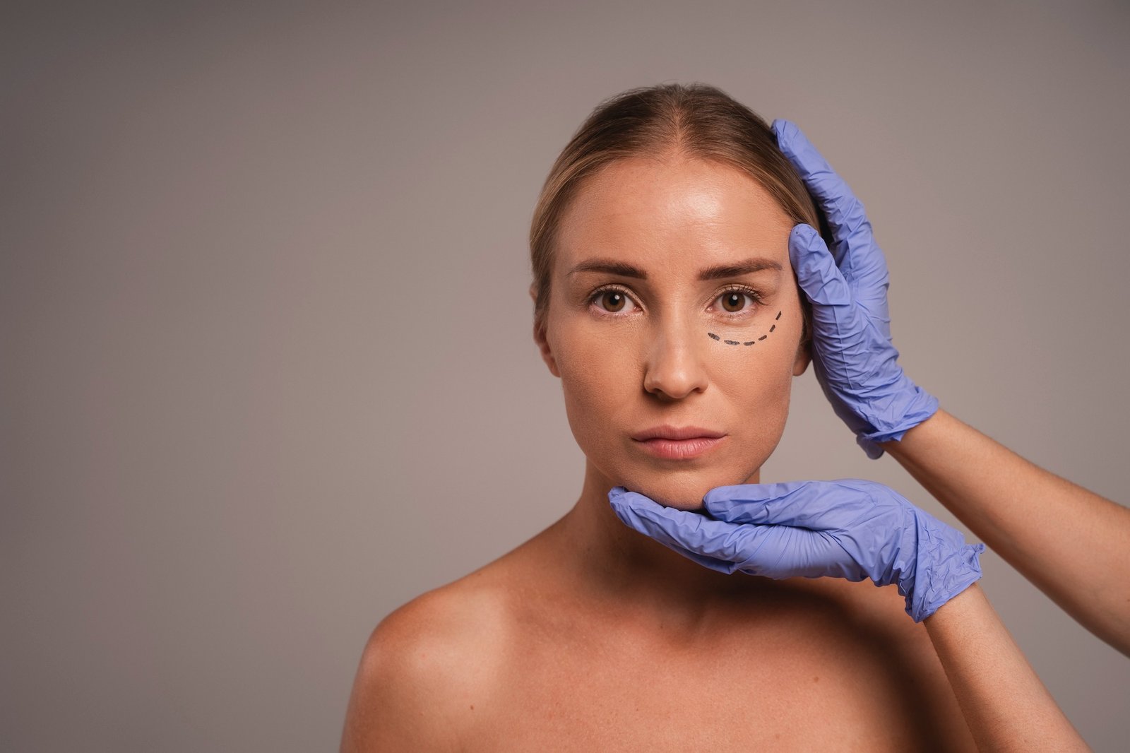 Mujer con líneas de marcación en el rostro mientras unas manos con guantes sostienen su cara durante una evaluación estética