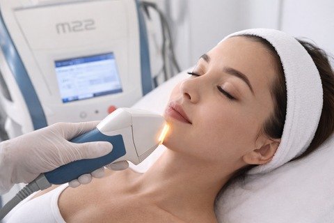 Mujer con banda en el cabello recibe luz pulsada en el rostro con la pieza de mano de un equipo Stellar M22