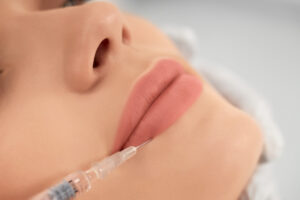 Resultados de los rellenos de labios