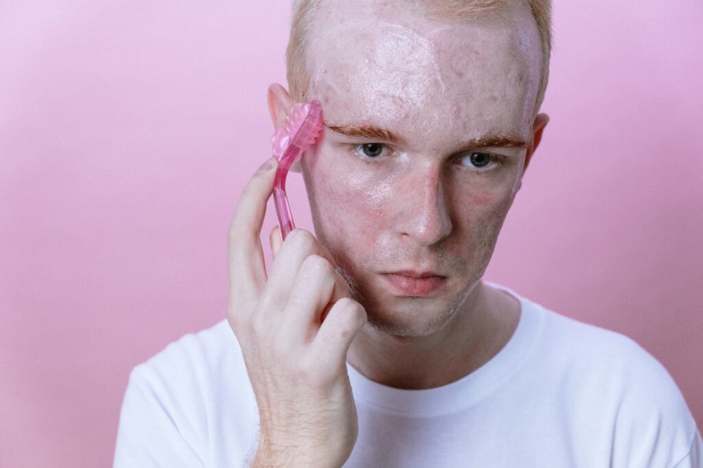 crema para evitar acné en la adolescencia