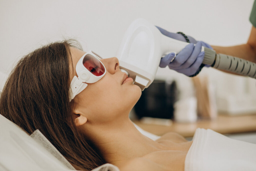 Beneficios de la IPL para el rostro