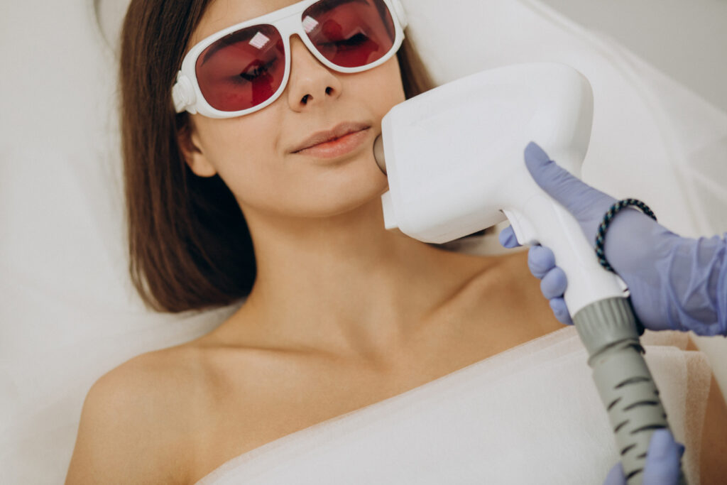tratamiento IPL para el rostro